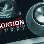 Ultrasound stethoscope and ABORTION crossed out in red