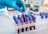 Gloved hand handling blood samples in a laboratory