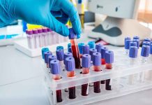 Gloved hand handling blood samples in a laboratory