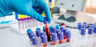 Gloved hand handling blood samples in a laboratory