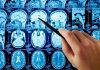 Hand pointing at brain scan images on screen