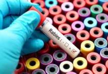 A hand in a blue glove holding a blood test tube labeled Rabies over colorful sample containers